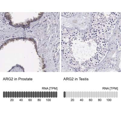 Immunohistochemistry-Paraffin: ARG2 Antibody [NBP1-86189] - Staining in human prostate and testis tissues using anti-ARG2 antibody. Corresponding ARG2 RNA-seq data are presented for the same tissues.