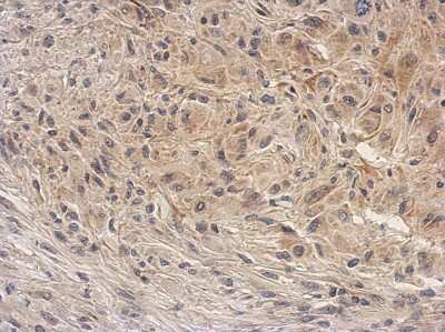 Immunohistochemistry-Paraffin: ARG2 Antibody [NBP2-15445] - Immunohistochemical analysis of paraffin-embedded U373 xenograft, using antibody at 1:500 dilution.