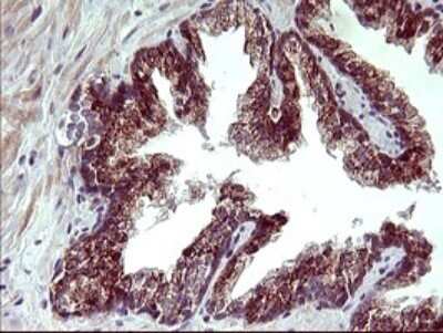 Immunohistochemistry: ARG2 Antibody (OTI3G5) - Azide and BSA Free [NBP2-70205] - Analysis of Human prostate tissue. (Heat-induced epitope retrieval by 10mM citric buffer, pH6.0, 120C for 3min)