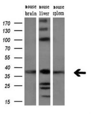 Western Blot: ARG2 Antibody (OTI3G5) - Azide and BSA Free [NBP2-70205] - Analysis of extracts (10ug) from 3 different mouse tissues, dilution (1:200).