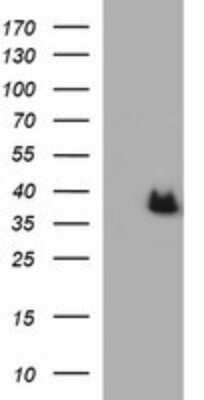 Western Blot: ARG2 Antibody (OTI3G5) - Azide and BSA Free [NBP2-70205] - Analysis of HEK293T cells were transfected with the pCMV6-ENTRY control (Left lane) or pCMV6-ENTRY ARG2.