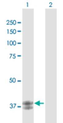 Western Blot: ARG2 Antibody [H00000384-D01P] - Analysis of ARG2 expression in transfected 293T cell line by ARG2 polyclonal antibody.Lane 1: ARG2 transfected lysate(38.60 KDa).Lane 2: Non-transfected lysate.