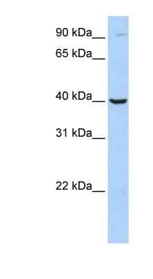 Western Blot: ARG2 Antibody [NBP1-54389] - Jurkat cell lysate, concentration 0.2-1 ug/ml.