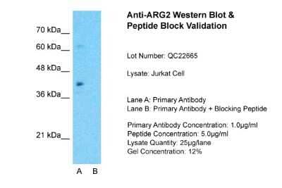 Western Blot: ARG2 Antibody [NBP1-54389] - Sample Tissue: Jurkat, Lane A: Primary Antibody, Lane B: Primary Antibody + Blocking Peptide, Primary Antibody Concentration: 1ug/ml, Peptide Concentration: 5ug/ml, Lysate Quantity: 25ug/lane/lane, Gel Concentration: 0.12