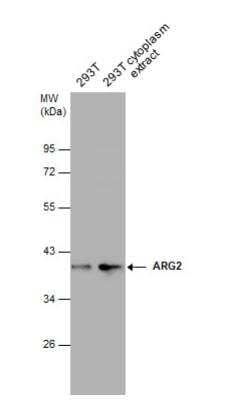 Western Blot: ARG2 Antibody [NBP2-15445] - 293T whole cell and cytoplasm extracts (30 ug) were separated by 10% SDS-PAGE, and the membrane was blotted with ARG2 antibody diluted at 1:1000.