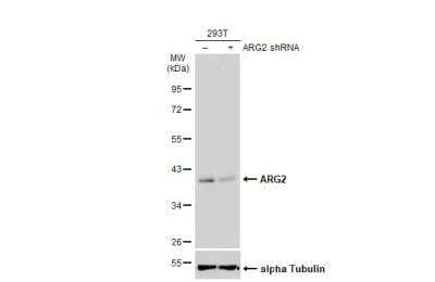 Western Blot: ARG2 Antibody [NBP2-15445] - Non-transfected (-) and transfected (+) 293T whole cell extracts (50 ug) were separated by 10% SDS-PAGE, and the membrane was blotted with ARG2 antibody diluted at 1:2000. HRP-conjugated anti-rabbit IgG antibody was used to detect the primary antibody.