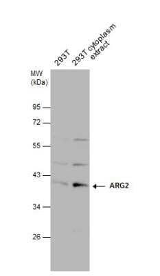 Western Blot: ARG2 Antibody [NBP2-15446] - 293T whole cell and cytoplasm extracts (30 ug) were separated by 10% SDS-PAGE, and the membrane was blotted with ARG2 antibody diluted at 1:1000.