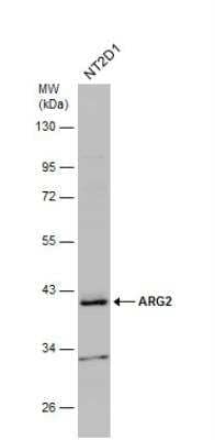 Western Blot: ARG2 Antibody [NBP2-15446] - Whole cell extract (30 ug) was separated by 10% SDS-PAGE, and the membrane was blotted with ARG2 antibody diluted at 1:1000.