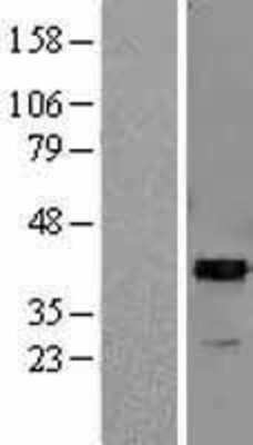 Western Blot: ARG2 Overexpression Lysate (Adult Normal) [NBL1-07663] Left-Empty vector transfected control cell lysate (HEK293 cell lysate); Right -Over-expression Lysate for ARG2.