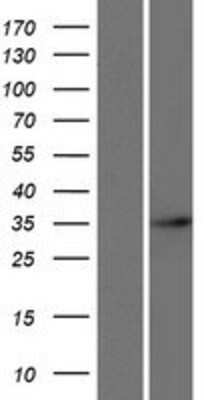 Western Blot: ARGFX Overexpression Lysate (Adult Normal) [NBP2-08701] Left-Empty vector transfected control cell lysate (HEK293 cell lysate); Right -Over-expression Lysate for ARGFX.