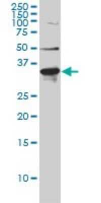 Western Blot: ARH Antibody (4G4-D5) [H00026119-M01] - LDLRAP1 monoclonal antibody (M01), clone 4G4-D5 Analysis of LDLRAP1 expression in Hela S3 NE.