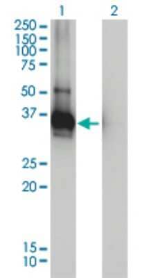 Western Blot: ARH Antibody (4G4-D5) [H00026119-M01] - Analysis of LDLRAP1 expression in transfected 293T cell line by LDLRAP1 monoclonal antibody (M01), clone 4G4-D5.Lane 1: LDLRAP1 transfected lysate(29 KDa).Lane 2: Non-transfected lysate.