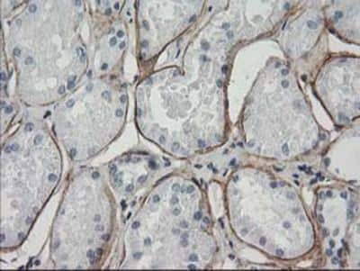 Immunohistochemistry-Paraffin: ARH Antibody (7E11) [NBP2-01435] - Staining of paraffin-embedded Human Kidney tissue using anti-ARH mouse monoclonal antibody.