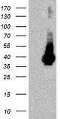 Western Blot: ARH Antibody (7E11) [NBP2-01435] - HEK293T cells were transfected with the pCMV6-ENTRY control (Left lane) or pCMV6-ENTRY ARH (Right lane) cDNA for 48 hrs and lysed. Equivalent amounts of cell lysates (5 ug per lane) were separated by SDS-PAGE and immunoblotted with anti-ARH.