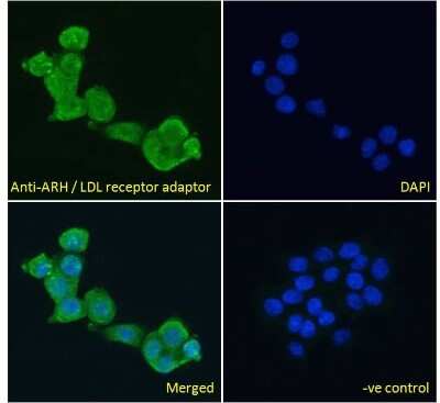 Immunocytochemistry/Immunofluorescence: ARH Antibody [NB100-1276] - analysis of paraformaldehyde fixed A431 cells, permeabilized with 0.15% Triton. Primary incubation 1hr (10ug/ml) followed by Alexa Fluor 488 secondary antibody (4ug/ml), showing cytoplasmic staining. The nuclear stain is DAPI (b