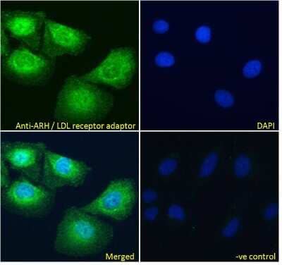 Immunocytochemistry/Immunofluorescence: ARH Antibody [NB100-1276] - analysis of paraformaldehyde fixed U2OS cells, permeabilized with 0.15% Triton. Primary incubation 1hr (10ug/ml) followed by Alexa Fluor 488 secondary antibody (4ug/ml), showing showing  cytoplasmic and some nuclear  staining. T