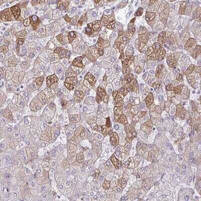 Immunohistochemistry-Paraffin: ARH Antibody [NBP2-48959] - Staining of human liver shows moderate cytoplasmic positivity in hepatocytes.