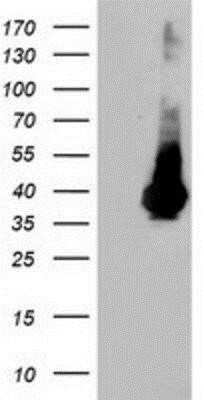 Western Blot: ARH Antibody (OTI7E11) - Azide and BSA Free [NBP2-71790] - HEK293T cells were transfected with the pCMV6-ENTRY control (Left lane) or pCMV6-ENTRY ARH (Right lane) cDNA for 48 hrs and lysed. Equivalent amounts of cell lysates (5 ug per lane) were separated by SDS-PAGE and immunoblotted with anti-ARH.