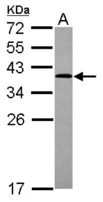 Western Blot: ARH Antibody [NBP2-15449] - Sample (30 ug of whole cell lysate) A: U87-MG 12% SDS PAGE gel, diluted at 1:1000.