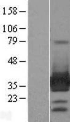 Western Blot: ARH Overexpression Lysate (Adult Normal) [NBL1-12478] Left-Empty vector transfected control cell lysate (HEK293 cell lysate); Right -Over-expression Lysate for ARH.