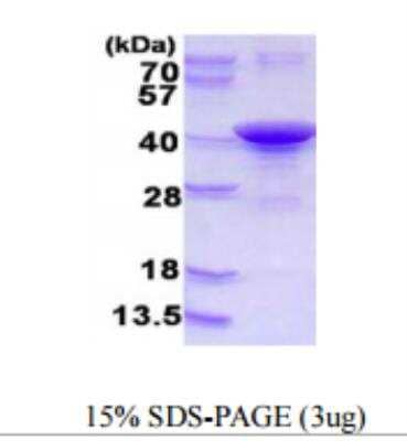 SDS-Page: ARH Recombinant Protein [NBP1-78895]