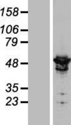 Western Blot: ARHGAP1 Overexpression Lysate (Adult Normal) [NBL1-07665] Left-Empty vector transfected control cell lysate (HEK293 cell lysate); Right -Over-expression Lysate for ARHGAP1.