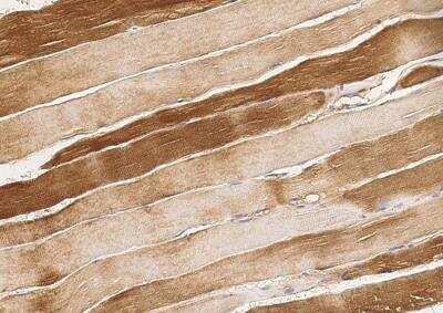 Immunohistochemistry-Paraffin: ARHGAP11B Antibody [NBP3-06142] - Staining of human ARHGAP11B in human skeletal muscle with rabbit polyclonal antibody (1:300).