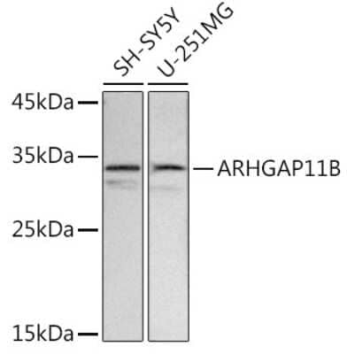 Western Blot: ARHGAP11B Antibody [NBP3-05582] - Western blot analysis of extracts of various cell lines, using ARHGAP11B antibody (NBP3-05582) at 1:500 dilution. Secondary antibody: HRP Goat Anti-Rabbit IgG (H+L) at 1:10000 dilution. Lysates/proteins: 25ug per lane. Blocking buffer: 3% nonfat dry milk in TBST. Detection: ECL Basic Kit. Exposure time: 2s.