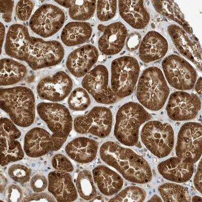 Immunohistochemistry ARHGAP15 Antibody - BSA Free