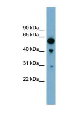 Western Blot ARHGAP15 Antibody - BSA Free