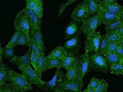 Immunocytochemistry/Immunofluorescence: ARHGAP17 Antibody [NBP2-97377] - Immunofluorescence staining of ARHGAP17 in U2OS cells. Cells were fixed with 4% PFA, permeabilzed with 0.1% Triton X-100 in PBS, blocked with 10% serum, and incubated with rabbit anti-Human ARHGAP17 polyclonal antibody (dilution ratio 1:100) at 4C overnight. Then cells were stained with the Alexa Fluor(R)488-conjugated Goat Anti-rabbit IgG secondary antibody (green) and counterstained with DAPI (blue).Positive staining was localized to Cytoplasm.