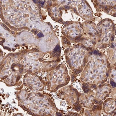 Immunohistochemistry-Paraffin: ARHGAP17 Antibody [NBP1-83870] - Staining of human placenta shows moderate cytoplasmic positivity in trophoblastic cells.