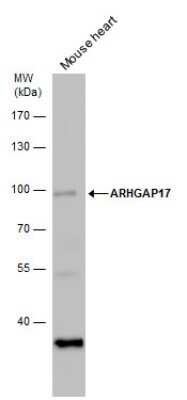 Western Blot: ARHGAP17 Antibody [NBP2-43545] - Analysis of mouse tissue extracts (50 ug) was separated by 7.5 % SDS-PAGE, and the membrane was blotted with ARHGAP17 antibody diluted by 1:1000.