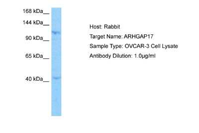 Western Blot: ARHGAP17 Antibody [NBP2-84449] - Host: Rabbit. Target Name: ARHGAP17. Sample Tissue: Human OVCAR-3 Whole Cell lysates. Antibody Dilution: 1ug/ml