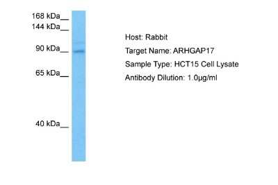 Western Blot: ARHGAP17 Antibody [NBP2-84450] - Host: Rabbit. Target Name: ARHGAP17. Sample Tissue: Human HCT15 Whole Cell lysates. Antibody Dilution: 1ug/ml