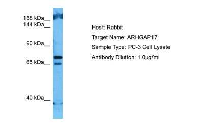 Western Blot: ARHGAP17 Antibody [NBP2-84451] - Host: Rabbit. Target Name: ARHGAP17. Sample Tissue: Human PC-3 Whole Cell lysates. Antibody Dilution: 1ug/ml