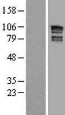 Western Blot ARHGAP17 Overexpression Lysate