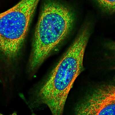 Immunocytochemistry/Immunofluorescence: ARHGAP18 Antibody [NBP1-94131] - Immunofluorescent staining of human cell line U-2 OS shows localization to nuclear speckles, plasma membrane & cytosol.