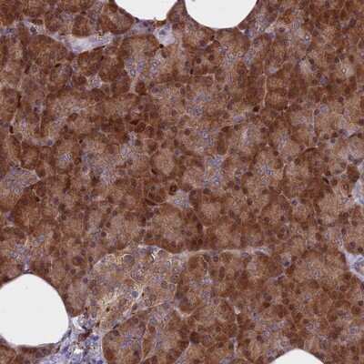 Immunohistochemistry-Paraffin: ARHGAP18 Antibody [NBP1-94131] - Staining of human pancreas shows strong cytoplasmic positivity in exocrine glandular cells.