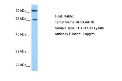 Western Blot: ARHGAP18 Antibody [NBP2-82653] - Host: Rabbit. Target Name: ARHGAP18. Sample Tissue: Human THP-1 Whole Cell lysates. Antibody Dilution: 1ug/ml