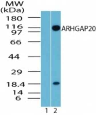 Western Blot: ARHGAP20 Antibody - Azide Free [NBP2-33261] - Analysis of ARHGAP20 in rat brain lysate. Lane 1 shows pre-immune sera. Lane 2 shows NBP2-24757 tested at 8 ug/ml. Image from the standard format of this antibody.