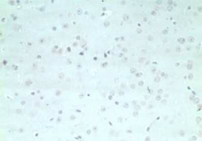 Immunohistochemistry: ARHGAP20 Antibody - Azide Free [NBP2-33261] - IHC staining of mouse brain using control (rabbit Ig) at 5 ug/ml. Image from the standard format of this antibody.