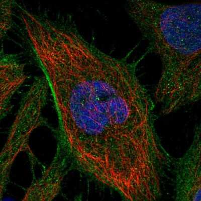 Immunocytochemistry/Immunofluorescence: ARHGAP21 Antibody [NBP2-55639] - Staining of human cell line HeLa shows localization to plasma membrane & actin filaments.