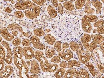 Immunohistochemistry-Paraffin: ARHGAP21 Antibody [NBP3-06052] - Immunochemical staining of human ARHGAP21 in human kidney with rabbit polyclonal antibody at 1:100 dilution, formalin-fixed paraffin embedded sections.