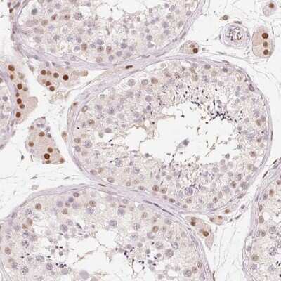 Immunohistochemistry: ARHGAP22 Antibody [NBP2-39028] - Staining of human testis shows strong nuclear positivity in Leydig cells.