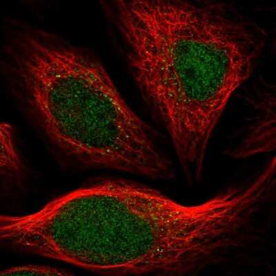 Immunocytochemistry/Immunofluorescence: ARHGAP23 Antibody [NBP2-54981] - Staining of human cell line U-2 OS shows localization to nucleus. Antibody staining is shown in green. 