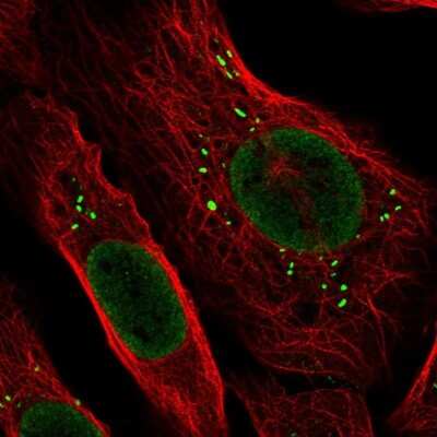 <b>Independent Antibodies Validation. </b>Immunocytochemistry/Immunofluorescence: ARHGAP25 Antibody [NBP2-57228] - Staining of human cell line U-2 OS shows localization to nucleoplasm & vesicles.
