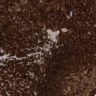 Immunohistochemistry-Paraffin: ARHGAP25 Antibody [NBP1-83053] - Staining of human tonsil shows strong cytoplasmic positivity in lymphoid cells outside reaction centra.