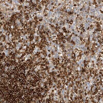 Immunohistochemistry-Paraffin: ARHGAP25 Antibody [NBP1-83053] - Staining of human spleen shows high expression.