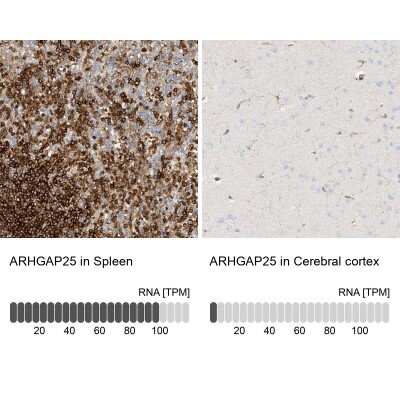 <b>Orthogonal Strategies Validation. </b>Immunohistochemistry-Paraffin: ARHGAP25 Antibody [NBP1-83053] - Staining in human spleen and cerebral cortex tissues using anti-ARHGAP25 antibody. Corresponding ARHGAP25 RNA-seq data are presented for the same tissues.